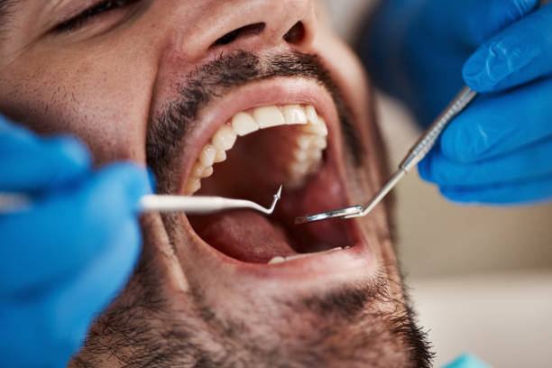 Best Tooth Pain Emergency Relief  in San Castle, FL